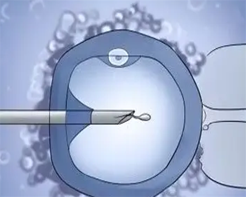 试管婴儿日记①